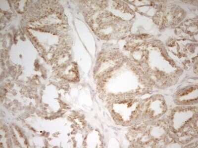 Immunohistochemistry: MRPL15 Antibody (OTI7A3) [NBP2-45936]