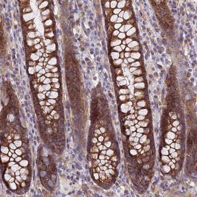 Immunohistochemistry-Paraffin: MRPL15 Antibody [NBP1-92137]