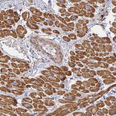 Immunohistochemistry-Paraffin: MRPL15 Antibody [NBP1-92137]