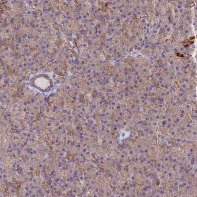 Immunohistochemistry-Paraffin: MRPL15 Antibody [NBP1-92137]