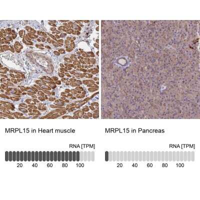 Immunohistochemistry-Paraffin: MRPL15 Antibody [NBP1-92137]