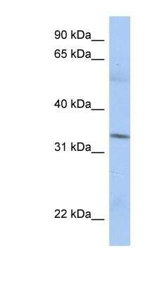 Western Blot: MRPL15 Antibody [NBP1-54662]