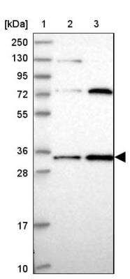 Western Blot: MRPL15 Antibody [NBP1-92137]
