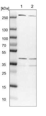 Western Blot: MRPL15 Antibody [NBP1-92137]