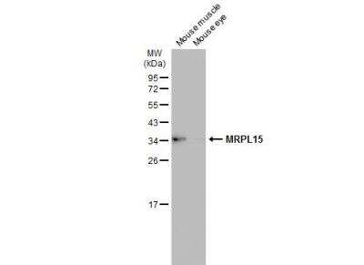 Western Blot: MRPL15 Antibody [NBP2-19399]
