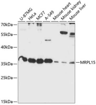 Western Blot: MRPL15 AntibodyAzide and BSA Free [NBP2-93456]