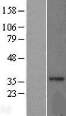 Western Blot: MRPL15 Overexpression Lysate [NBL1-13238]