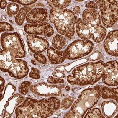 Immunohistochemistry-Paraffin: MRPL16 Antibody [NBP2-49119]