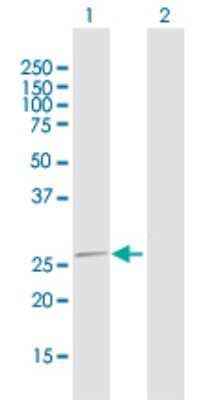 Western Blot: MRPL16 Antibody [H00054948-D01P]