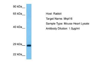 Western Blot: MRPL16 Antibody [NBP2-85314]