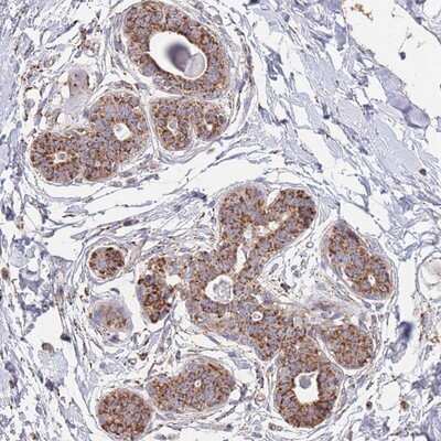 Immunohistochemistry-Paraffin: MRPL17 Antibody [NBP2-13611]