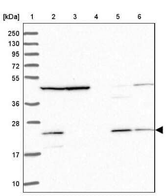 Western Blot: MRPL17 Antibody [NBP2-13611]