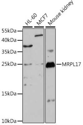 Western Blot: MRPL17 AntibodyAzide and BSA Free [NBP2-94299]