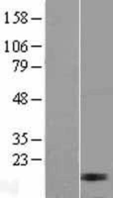 Western Blot: MRPL17 Overexpression Lysate [NBL1-13240]