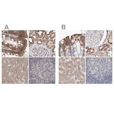 Immunohistochemistry-Paraffin: MRPL18 Antibody [NBP1-83176]