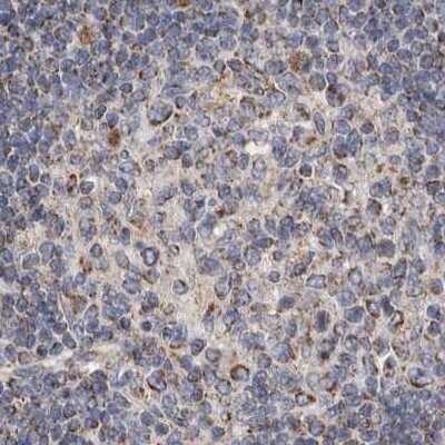 Immunohistochemistry-Paraffin: MRPL18 Antibody [NBP1-83176]