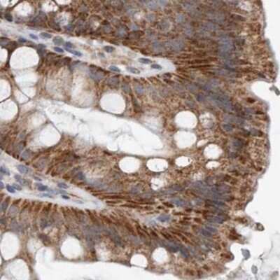 Immunohistochemistry-Paraffin: MRPL18 Antibody [NBP1-83176]