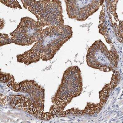 Immunohistochemistry-Paraffin: MRPL18 Antibody [NBP1-83177]
