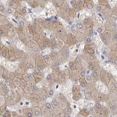 Immunohistochemistry-Paraffin: MRPL18 Antibody [NBP1-83177]