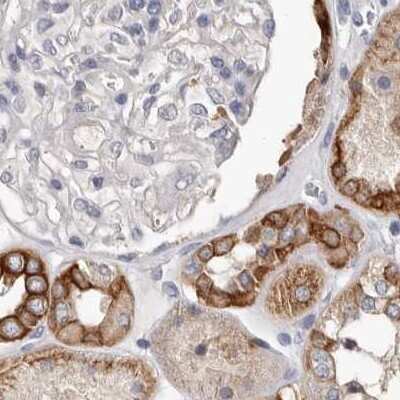 Immunohistochemistry-Paraffin: MRPL18 Antibody [NBP1-83177]