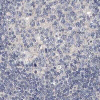 Immunohistochemistry-Paraffin: MRPL18 Antibody [NBP1-83177]