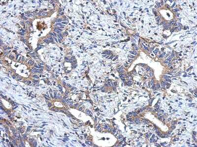 Immunohistochemistry-Paraffin: MRPL18 Antibody [NBP2-19400]