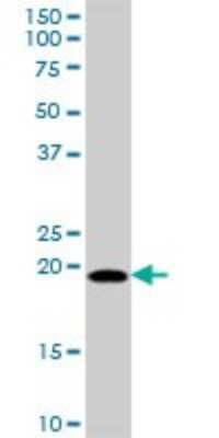 Western Blot: MRPL18 Antibody [H00029074-B01P]