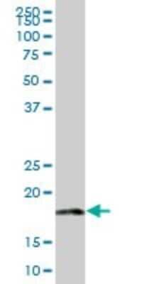 Western Blot: MRPL18 Antibody [H00029074-B01P]