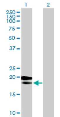 Western Blot: MRPL18 Antibody [H00029074-B01P]