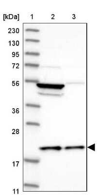 Western Blot: MRPL18 Antibody [NBP1-83176]