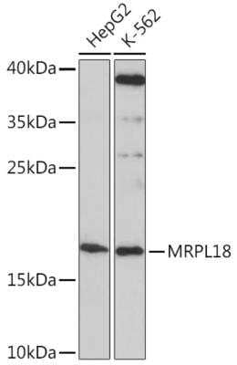 Western Blot: MRPL18 AntibodyAzide and BSA Free [NBP2-94040]