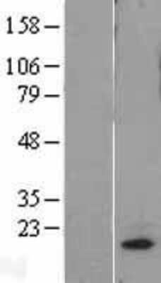 Western Blot: MRPL18 Overexpression Lysate [NBL1-13241]