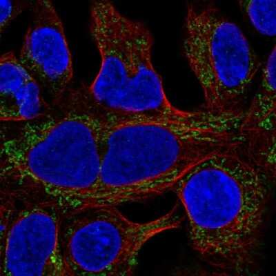 Immunocytochemistry/ Immunofluorescence: MRPL19 Antibody [NBP2-56761]