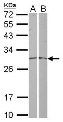 Western Blot: MRPL19 Antibody [NBP2-15023]