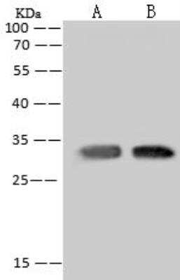 Western Blot: MRPL19 Antibody [NBP3-12549]