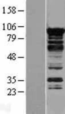 Western Blot: MRPL19 Overexpression Lysate [NBP2-04345]