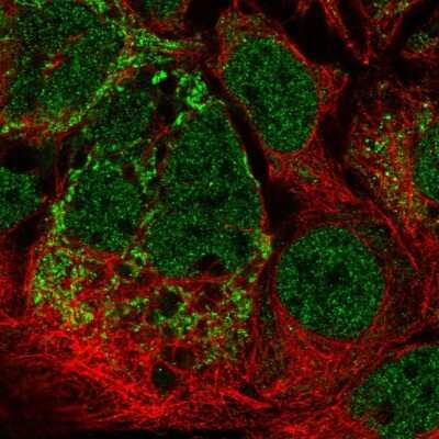 Immunocytochemistry/ Immunofluorescence: MRPL2 Antibody [NBP2-57589]