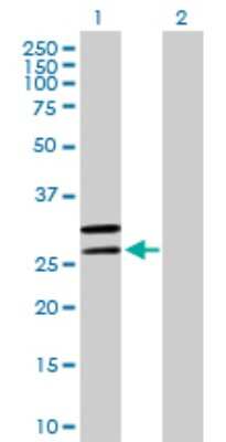 Western Blot: MRPL2 Antibody [H00051069-B01P]