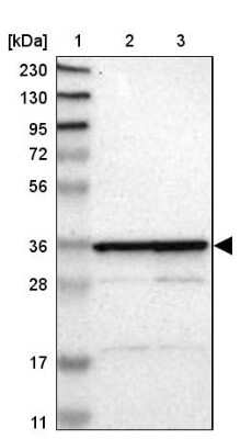 Western Blot: MRPL2 Antibody [NBP1-84513]