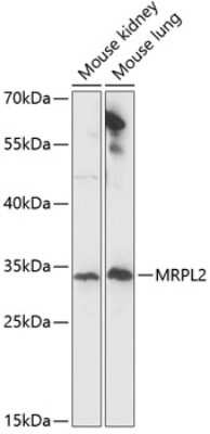 Western Blot: MRPL2 AntibodyAzide and BSA Free [NBP2-93494]