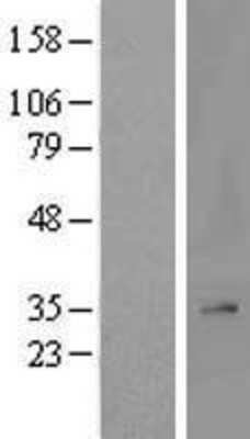 Western Blot: MRPL2 Overexpression Lysate [NBL1-13243]