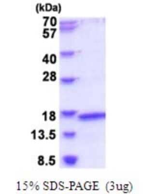 SDS-PAGE: Recombinant Human MRPL2 His Protein [NBP2-51912]