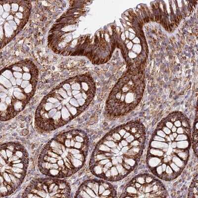 Immunohistochemistry-Paraffin: MRPL20 Antibody [NBP1-92138]