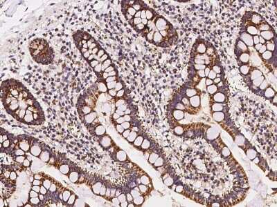 Immunohistochemistry-Paraffin: MRPL20 Antibody [NBP2-98645]
