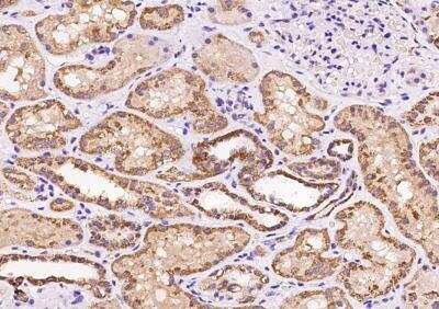 Immunohistochemistry-Paraffin: MRPL20 Antibody [NBP2-98645]