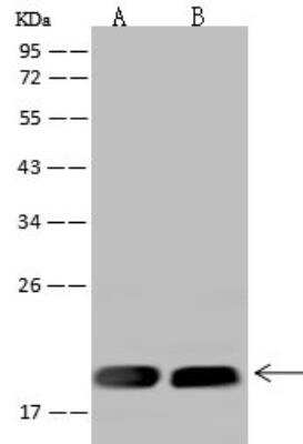 Western Blot: MRPL20 Antibody [NBP2-98645]