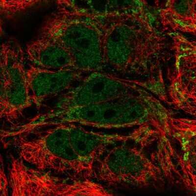 Immunocytochemistry/ Immunofluorescence: MRPL21 Antibody [NBP2-13612]
