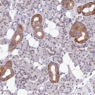 Immunohistochemistry-Paraffin: MRPL21 Antibody [NBP2-13612]
