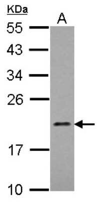 Western Blot: MRPL21 Antibody [NBP2-19402]