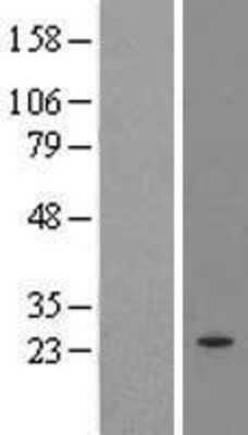 Western Blot: MRPL21 Overexpression Lysate [NBL1-13245]